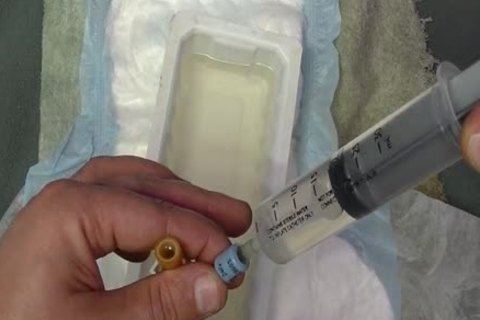 I put in A 24 French Catheter In Me. I Take In 500 ML Of Water In My Bladder. whilst My Bladder Is To The Bursting Point Play With Myself To The Point