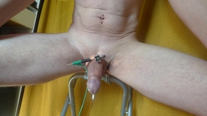 E-Stim weenie Pins Electrodes cum Ejac